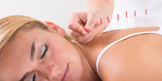 Medecine traditionnelle chinoise : les atouts sante et prevention de l’acupuncture