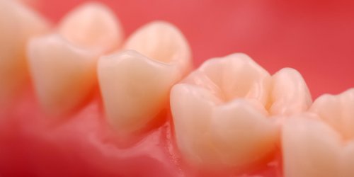 Dechaussement dentaire : pourquoi la gencive est-elle sensible ?