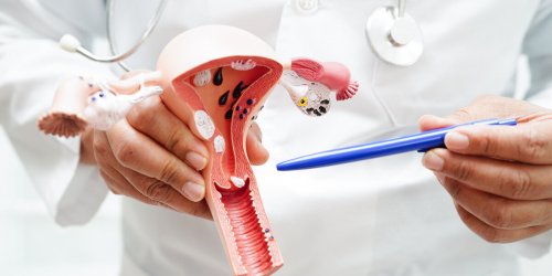 Cancer du col de l’uterus : l’ajout d’un type de traitement a la therapie proposee reduirait les risques de recidive de 35 %