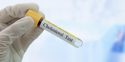 Le taux de cholesterol HDL peut-il etre trop bas ?