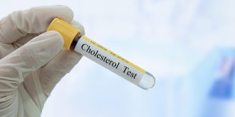 Le taux de cholesterol HDL peut-il etre trop bas ?