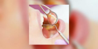 Dents déchaussées, quelle chirurgie ?