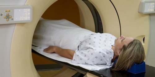 Diagnostic du cancer du poumon : le PET scan