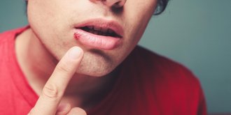 Herpes : prevenir le bouton de fievre, c-est possible !