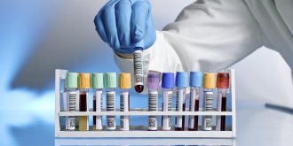 La creatinine, c’est quoi ?
