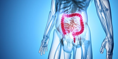 Le colon irritable favorise-t-il le cancer ?