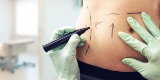 Obesite : les plus de la chirurgie