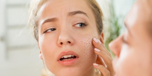 Demangeaisons : une peau seche peut etre un signe d-allergie