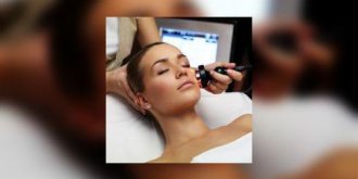 Beaute de la peau : pleins feux sur la photorejuvenation