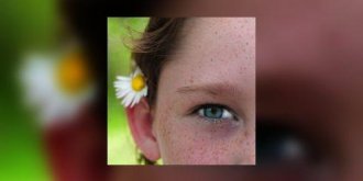 Le chalazion de l’enfant : benin mais recidivant