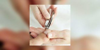 Comment soigne-t-on l'ongle incarné ?