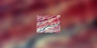 Interview : reparer un coeur apres un infactus du myocarde