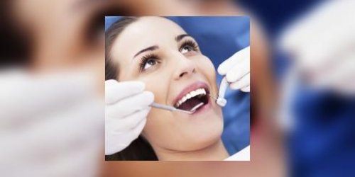 Dentaire : blanchiment des dents, facettes ou inlays ?