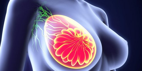 Boule, demangeaison... les signes d-alerte du cancer du sein