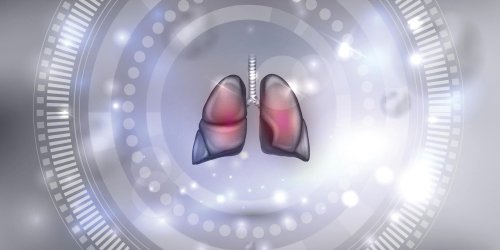 Bronchite chronique : un signe possible de cancer du poumon