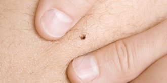 Maladie de Lyme : comment prevenir les morsures de tiques ?