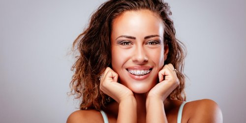 Appareil dentaire : la duree du traitement orthodontique chez l-adulte