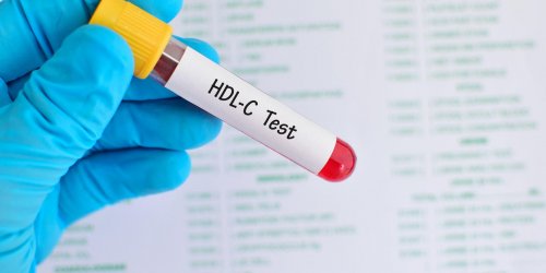 Bilan lipidique : le cholesterol HDL a un role important