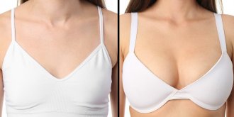 Techniques modernes en chirurgie mammaire : ce qu’il faut connaitre avant de se lancer