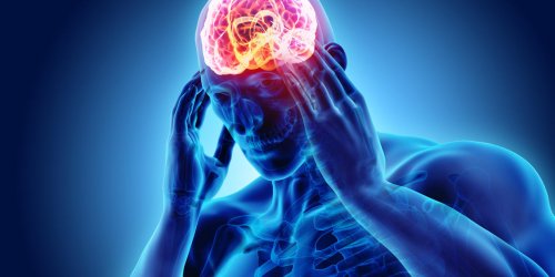 Migraine avec aura : un signe possible de cancer du cerveau ?