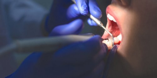En Inde, un garcon de 7 ans se fait enlever 526 dents
