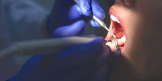 En Inde, un garcon de 7 ans se fait enlever 526 dents