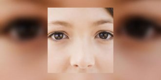 Conjonctivite : ne vous frottez pas les yeux !