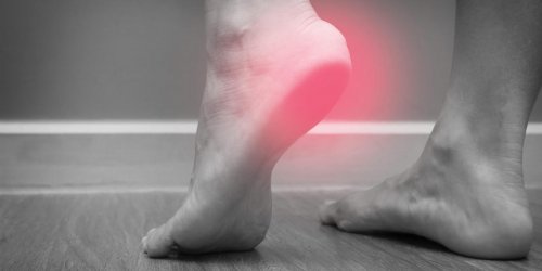 Douleur au talon : comment savoir si c-est le tendon d-Achille