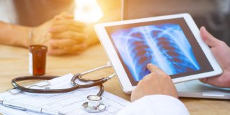 Sarcoïdose pulmonaire : comment la reconnaître