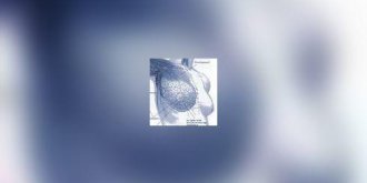 Feu vert au depistage du cancer du sein genetique