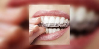 Orthodontie : des techniques ultramodernes pour un beau sourire