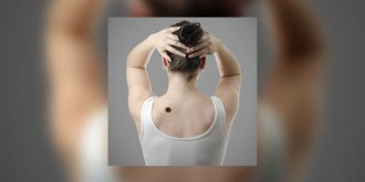 Angiome : pourquoi et comment traiter ?