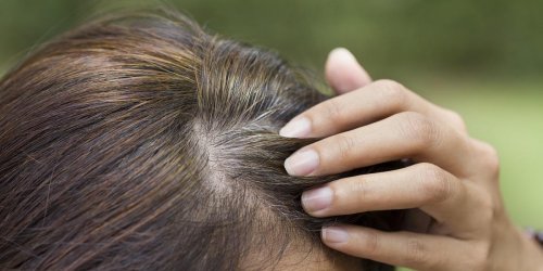 5 conseils pour eviter les cheveux gris