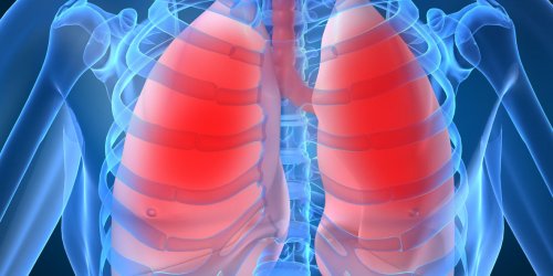 Pneumopathie : une infection des poumons qui donne de la fievre