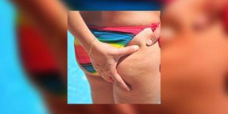 Cellulite : comment fonctionnent les armes anti-cellulite ?