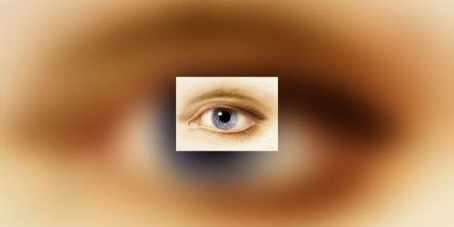 Les corticoides majorent le risque de cataracte