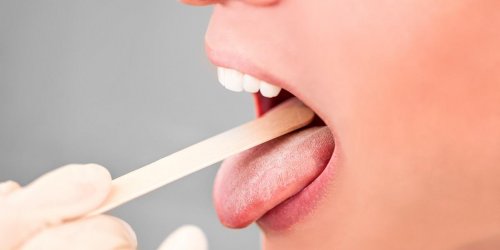 Quels sont les symptomes du cancer de la langue ? 