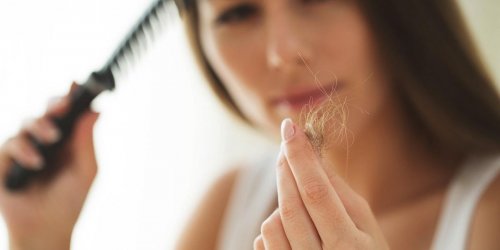 Pelade, alopecie : risquez-vous de devenir chauve ?