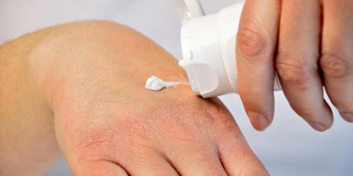 6 effets que peut avoir la cortisone sur votre peau