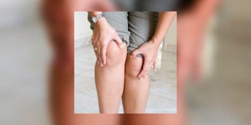 Le genou valgum, une malformation des genoux