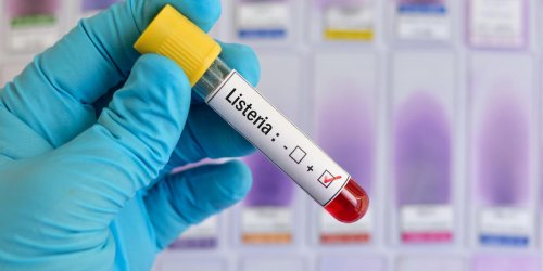 Listeria chez la femme enceinte : les risques