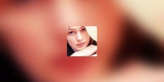 Herpès labial : agir dès les premiers signes