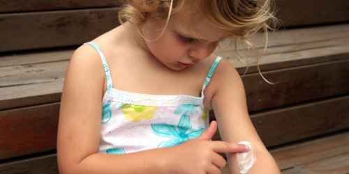 Eczema de l-enfant : que faire ?