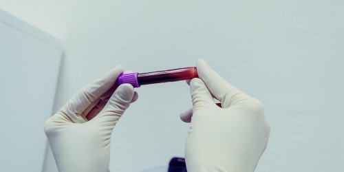 Analyse de sang : la norme du taux de CRP