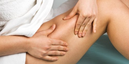 Avez-vous les bons reflexes contre la cellulite ?