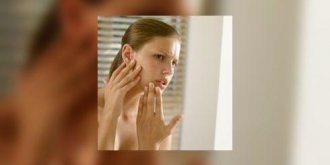 Urticaire : et si c’était le stress ?