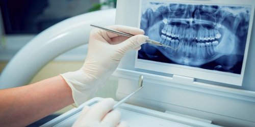 Les dents, victimes collaterales de certaines maladies 