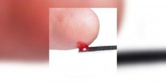 Depistage a domicile du virus du sida : l’autotest sera disponible fin juin