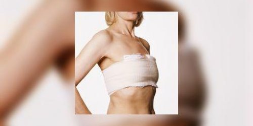Reconstruction mammaire : seules 3 femmes sur 10 !