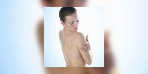 Cancer de la peau et melanome : sauvez votre peau !